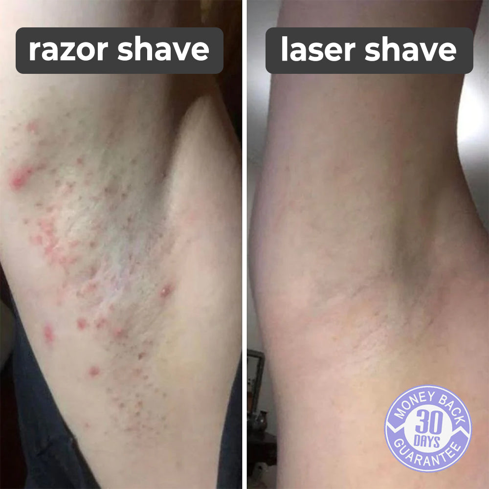 SilkySkin Laser Hair Remover